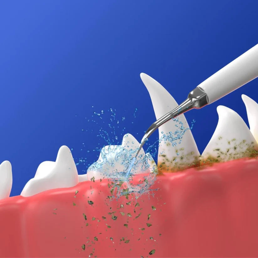 Full Head Replacement – Complete 9-Piece Set
